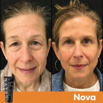 Crème Anti Cernes et Rides Instantanée